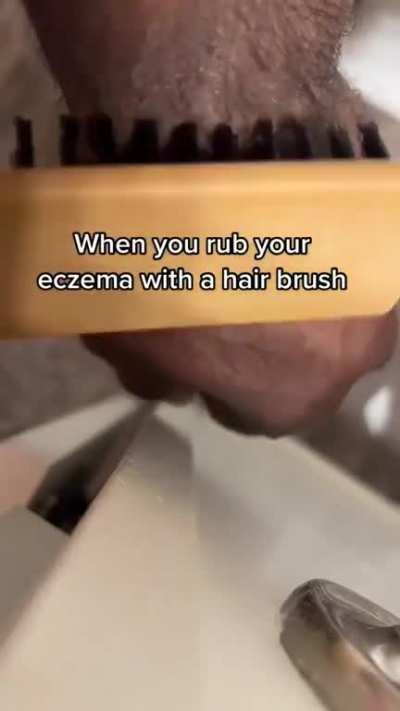 When you rub your eczema with a hair brush