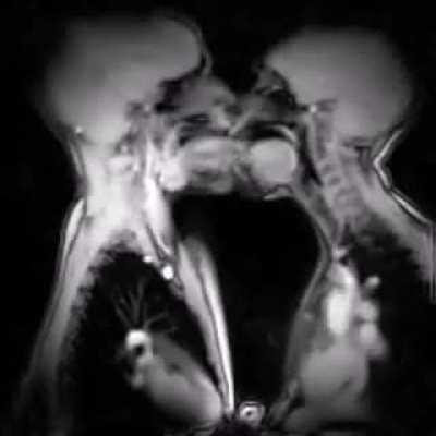 How does kissing look in MRI (Magnetic resonance imaging)