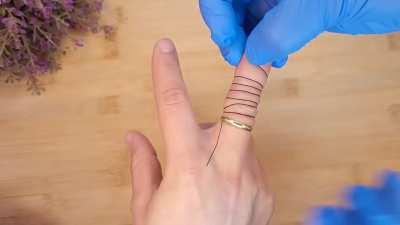 how to remove the ring that was stuck on a finger