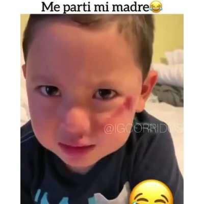 Que te pasó mijo?