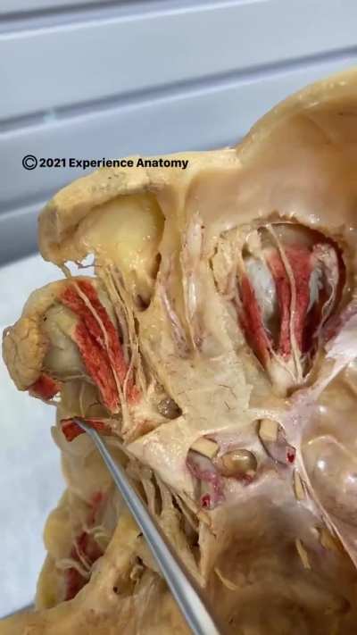 This is what the muscles behind your eyes look like