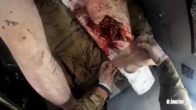 [NSFW] Ukrainian medics evacuating heavily wounded soldiers.