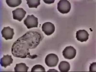 Human white blood cell chasing after a bacteria