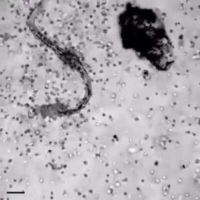 Roundworm being attacked by white blood cells