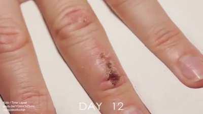 33 days of wound healing