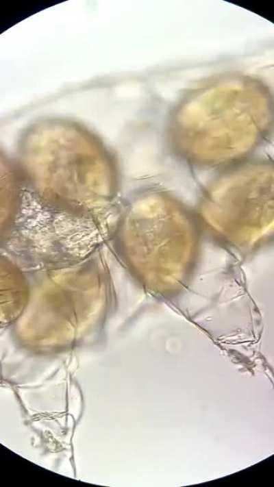 Waterbear being born