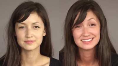 “Asian glow” - before and after drinking alcohol