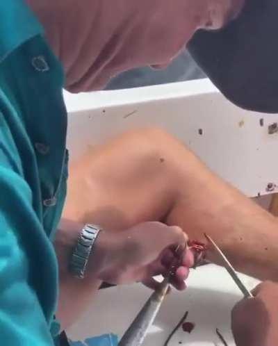 Removing a fishing hook, but badly