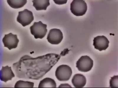 Fascinating footage of a human white blood cell chasing a bacterium captured through a microscope. Credit: David Rogers