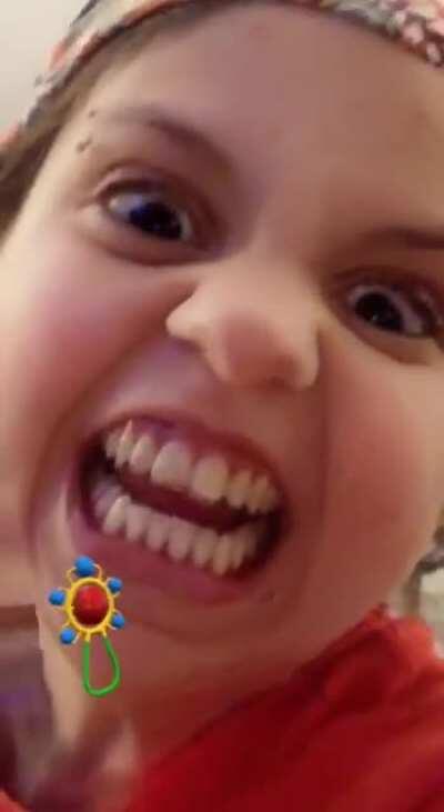 Baby's don't have that much teeth