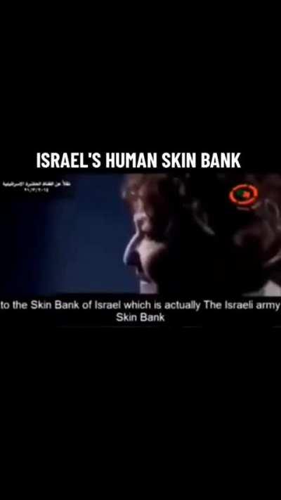 Biggest skin bank is harvested from murdered Palestinians and foreign workers.