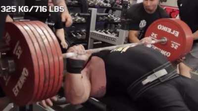 Powerlifter suffers a pectoral tear