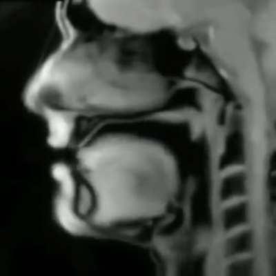 An MRI of a person speaking.