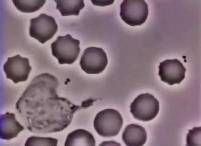 Fascinating footage of a human white blood cell chasing a bacterium captured through a microscope