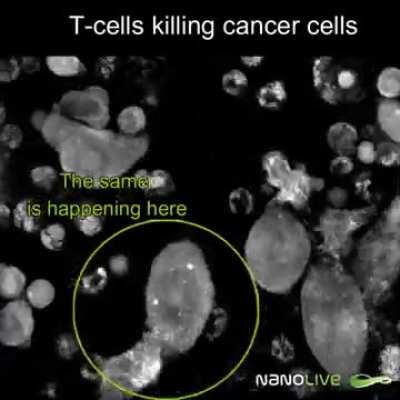 Label-free Live Cell Imaging: T-cells killing colon cancer cells