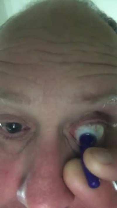 Taking out a contact lens