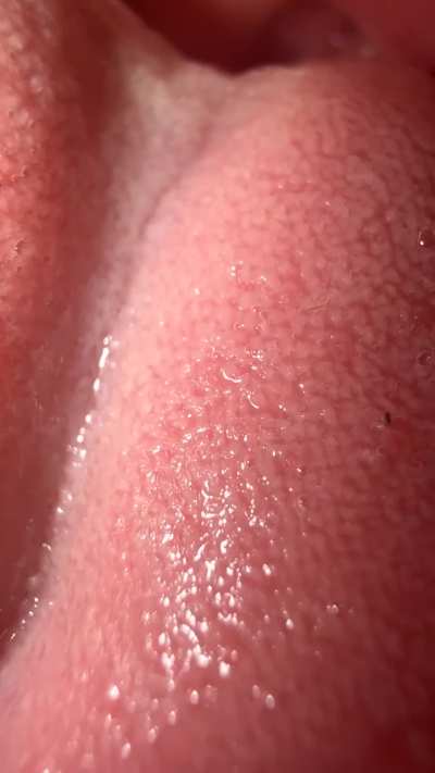 vorepics