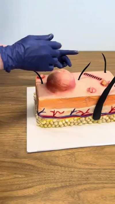 A dermatologist’s birthday cake