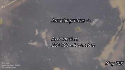 Comparing the size of common microorganisms under the microscope