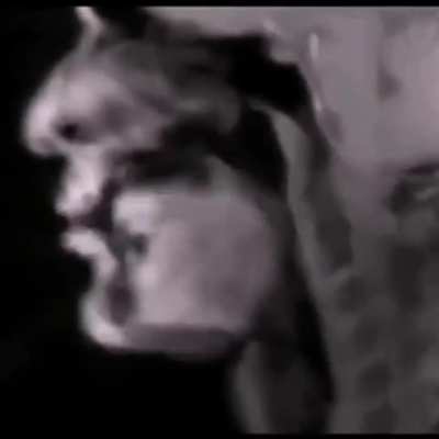 Here's what beatboxing looks like on a realtime MRI scan.