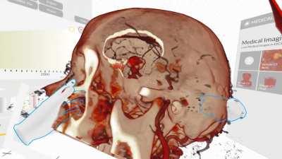 Working on DICOM in a Virtual Reality app. Would you use something like this for surgery planning?