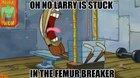 Larry is stuck in the femur breaker